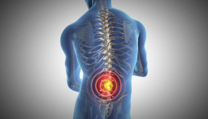 arthritis back pain_Cweb